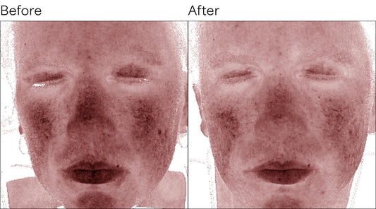 Isomers Skincare Simple Science Ceramide Duo