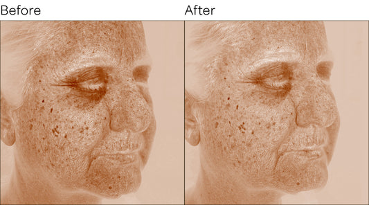 Isomers Skincare Platinum Peptide Radiance Duo