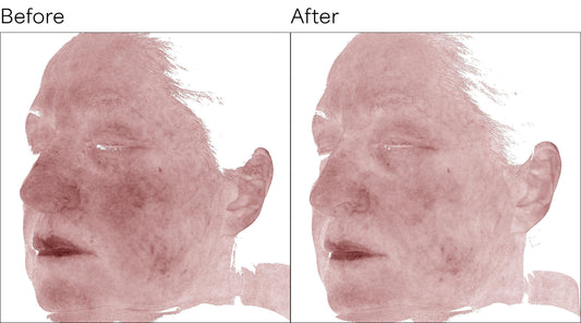 Isomers Skincare Simple Science Pore Perfecting Duo