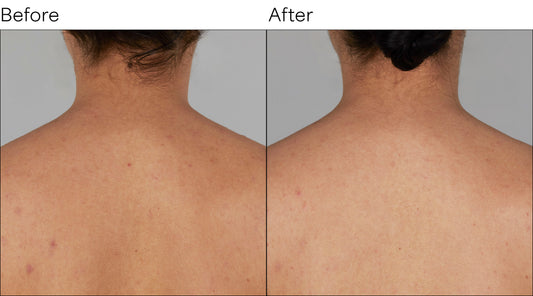 Isomers Skincare Vitamin C After Sun Body Cream BOGO