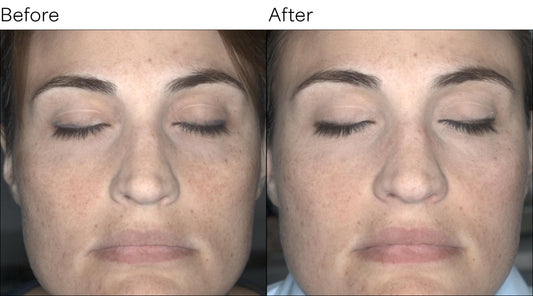 Isomers Skincare Vitamin C Brightening Cream BOGO
