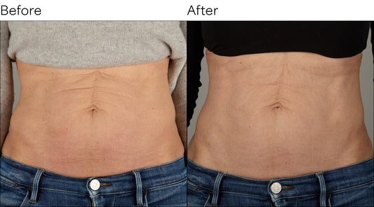 Isomers Skincare Collagen Body Renewal Duo