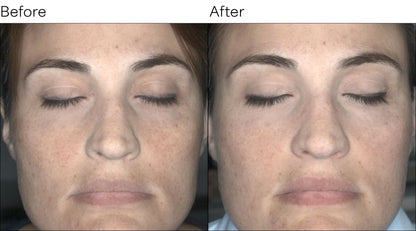 Isomers Skincare Vitamin C Brightening Cream 50ml