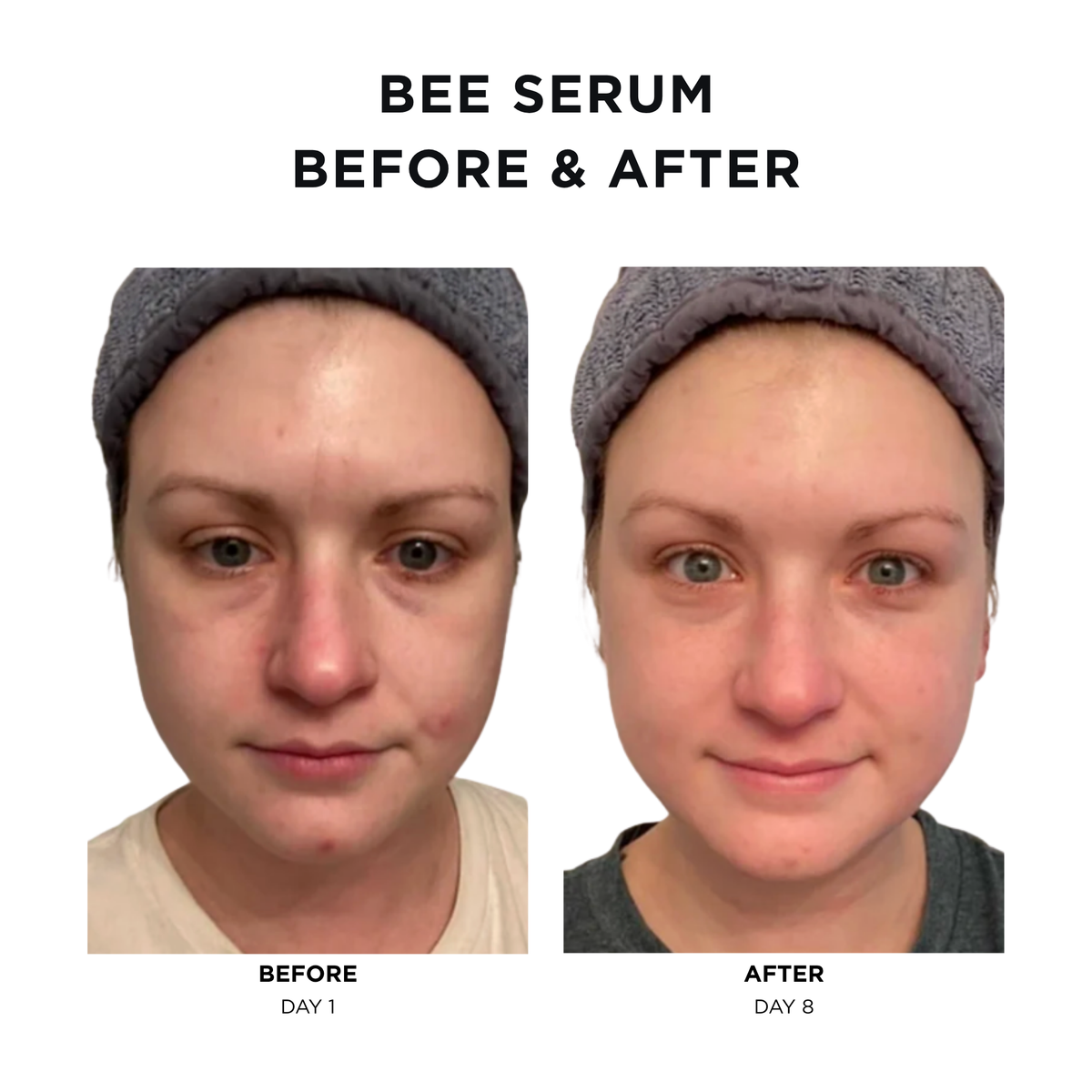 Intoxicated Cosmetics Anti-Aging Bee Venom Face Serum
