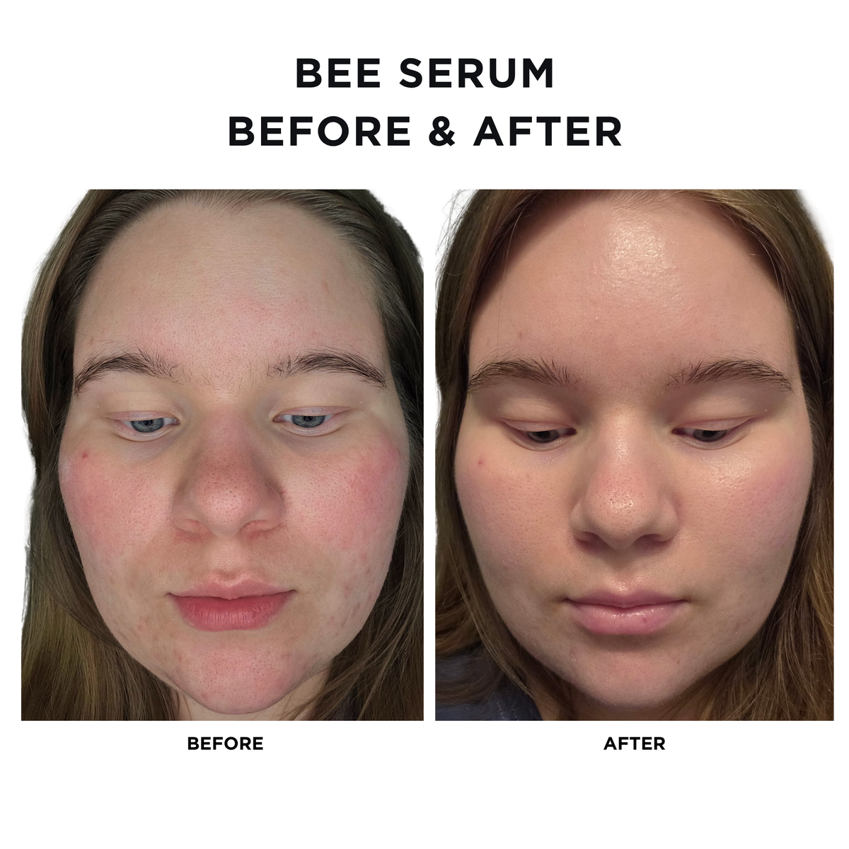 Intoxicated Cosmetics Anti-Aging Bee Venom Face Serum