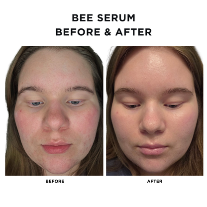 Intoxicated Cosmetics Anti-Aging Bee Venom Face Serum