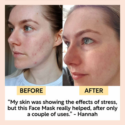 UpCircle Kaolin Clay Face Mask