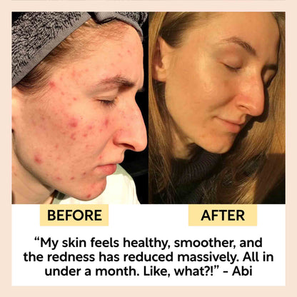 UpCircle Kaolin Clay Face Mask