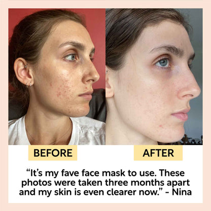 UpCircle Kaolin Clay Face Mask