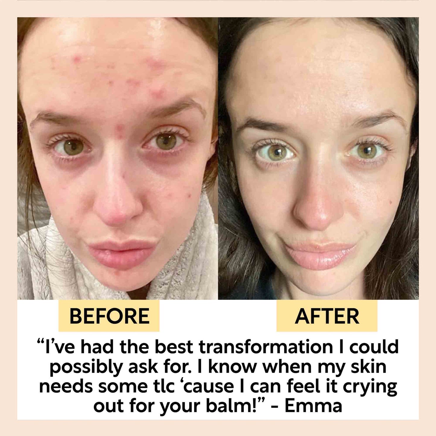 UpCircle Cleansing Face Balm w/ Oat Oil & Vitamin E