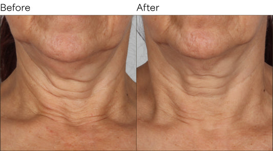 Isomers Skincare Gold Collagen Peptide Firming Neck Care BOGO