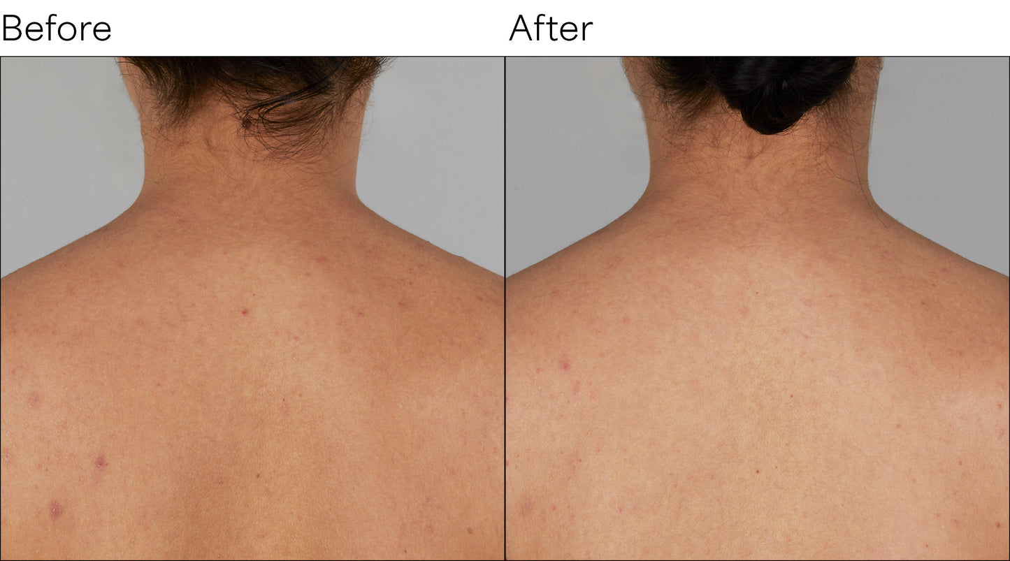 Isomers Skincare Vitamin C After Sun Body Cream BOGO