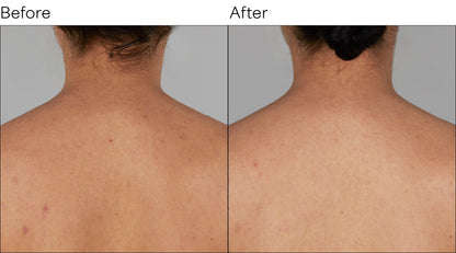 Isomers Skincare Vitamin C After Sun Body Cream BOGO