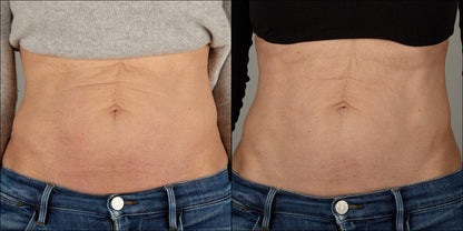 Isomers Skincare Diamond Peptide Spicule Body Cream 100ml