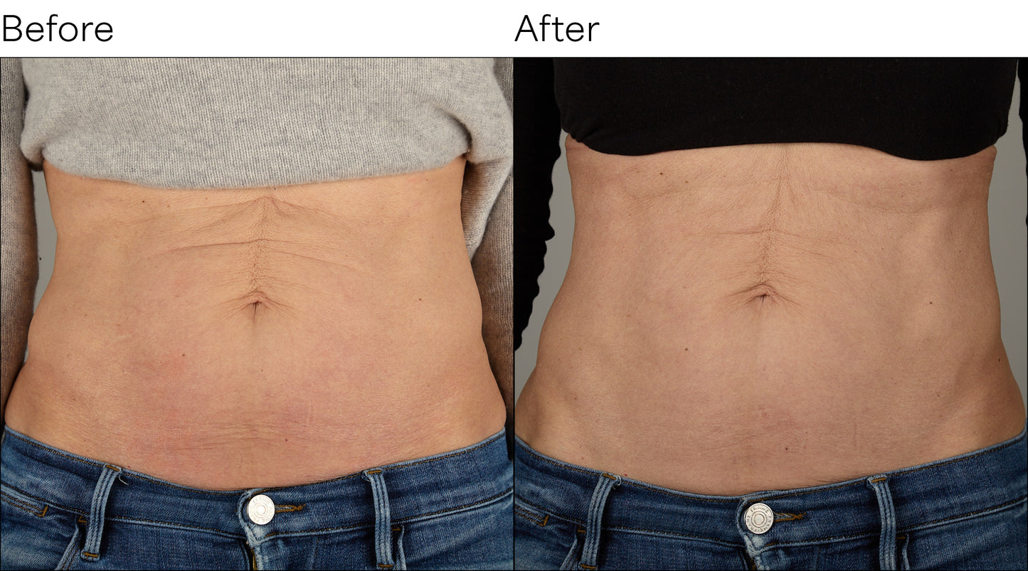Isomers Skincare Collagen Body Renewal Duo