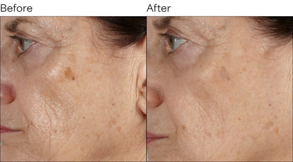 Isomers Skincare Essential Hydrating Cream BOGO