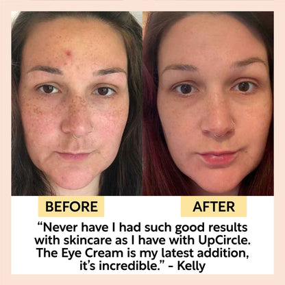 UpCircle Eye Cream with Hyaluronic Acid & Coffee