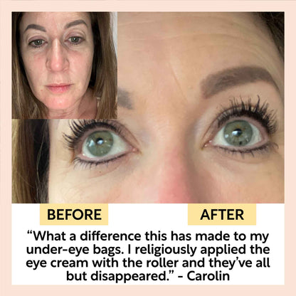 UpCircle The Caffeinated Duo w/ Eye Roller