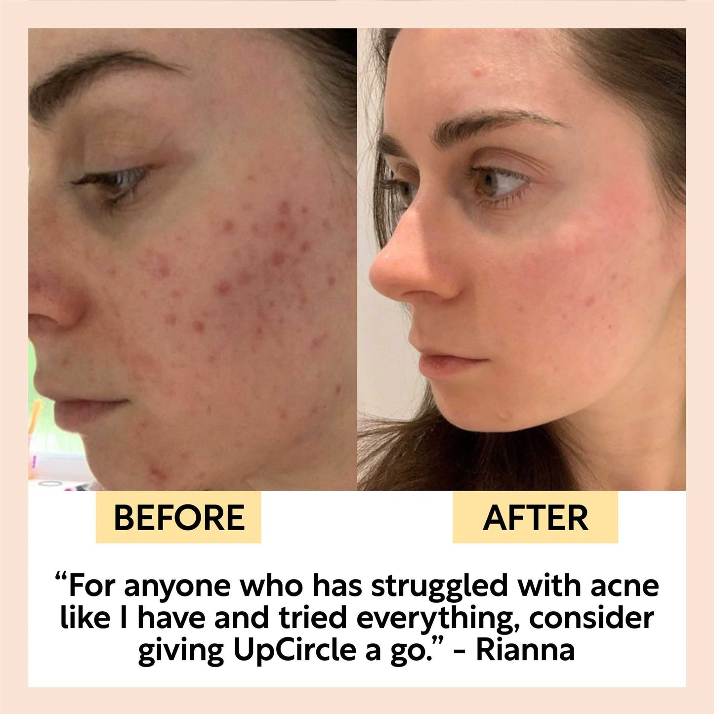 UpCircle Face Toner w/ Hyaluronic Acid
