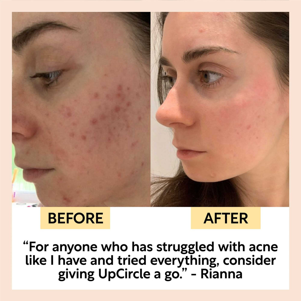 UpCircle Face Toner w/ Hyaluronic Acid