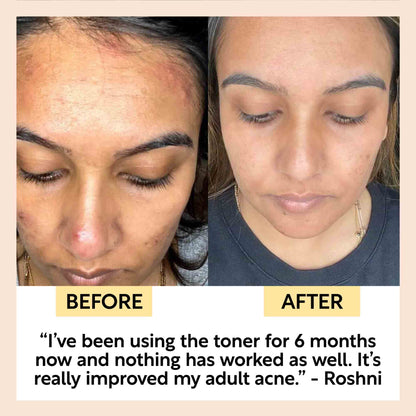 UpCircle Face Toner w/ Hyaluronic Acid