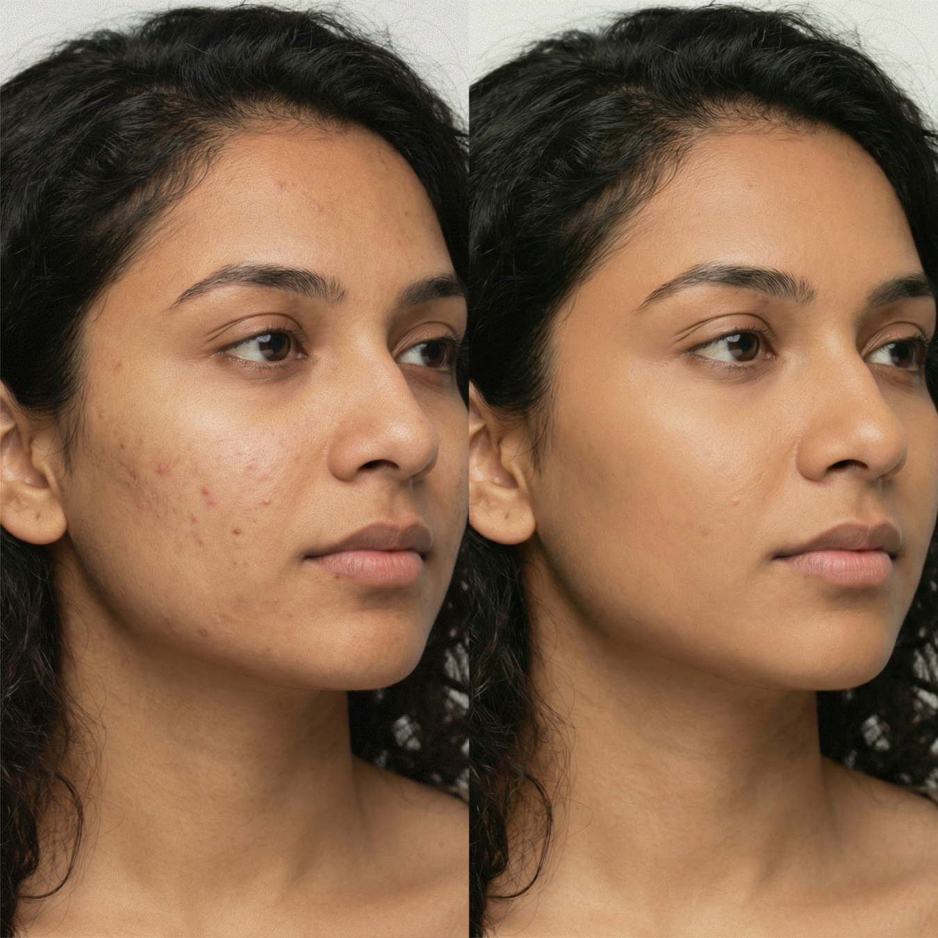 AmazingCosmetics Water-Resistant Antioxidant-Rich Amazing Concealer