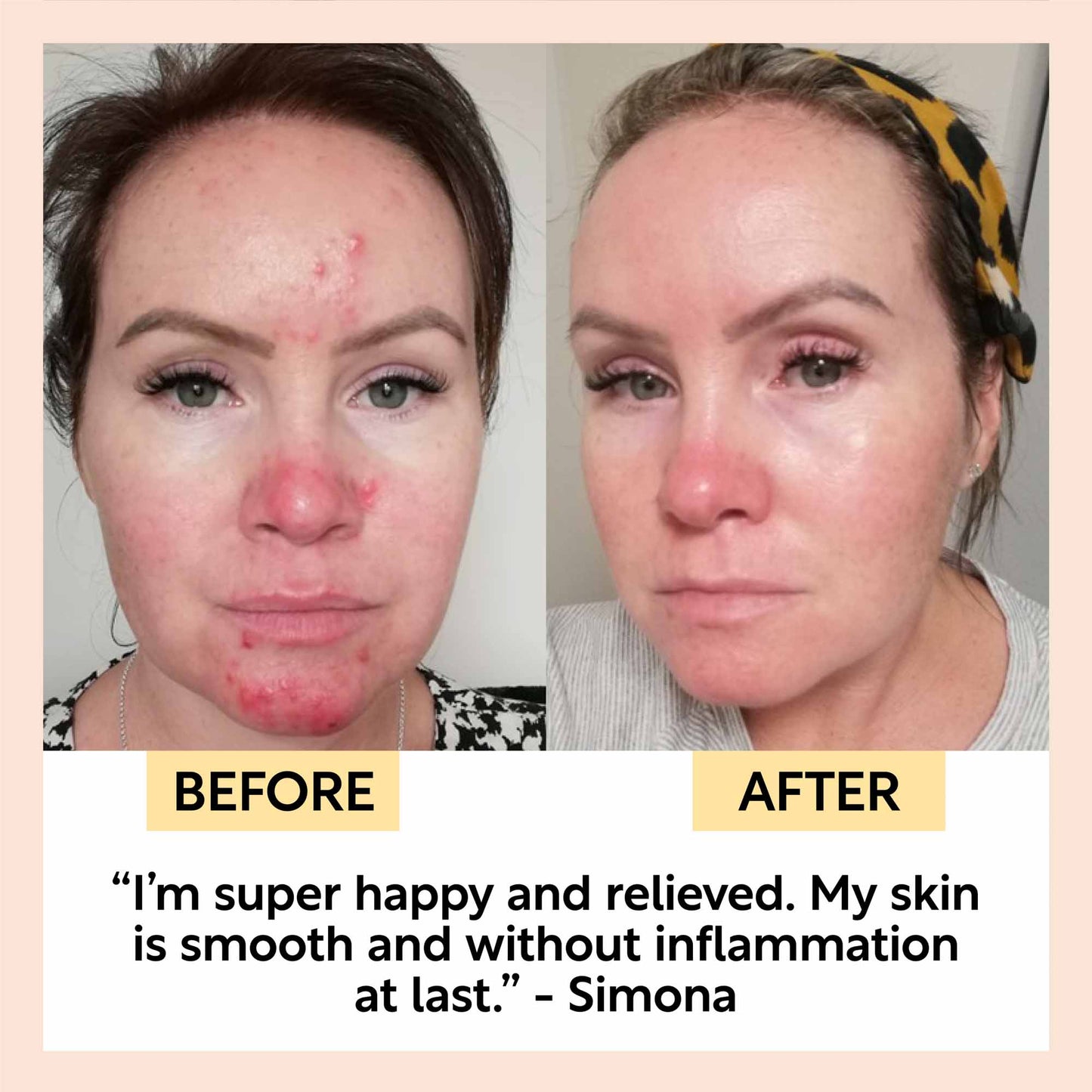 UpCircle Night Cream w/ Hyaluronic Acid & Niacinamide
