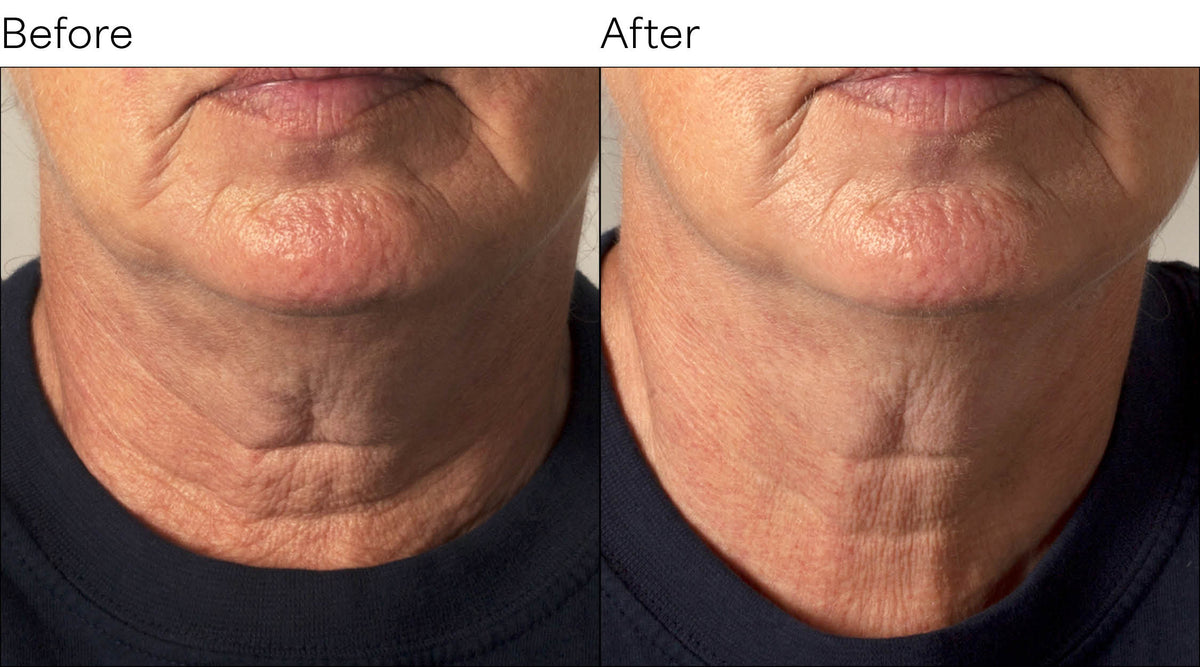 StemGenesis Orchid Neck Sculpt Cream 50ml
