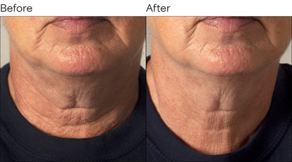 StemGenesis Orchid Neck Sculpt Cream 50ml