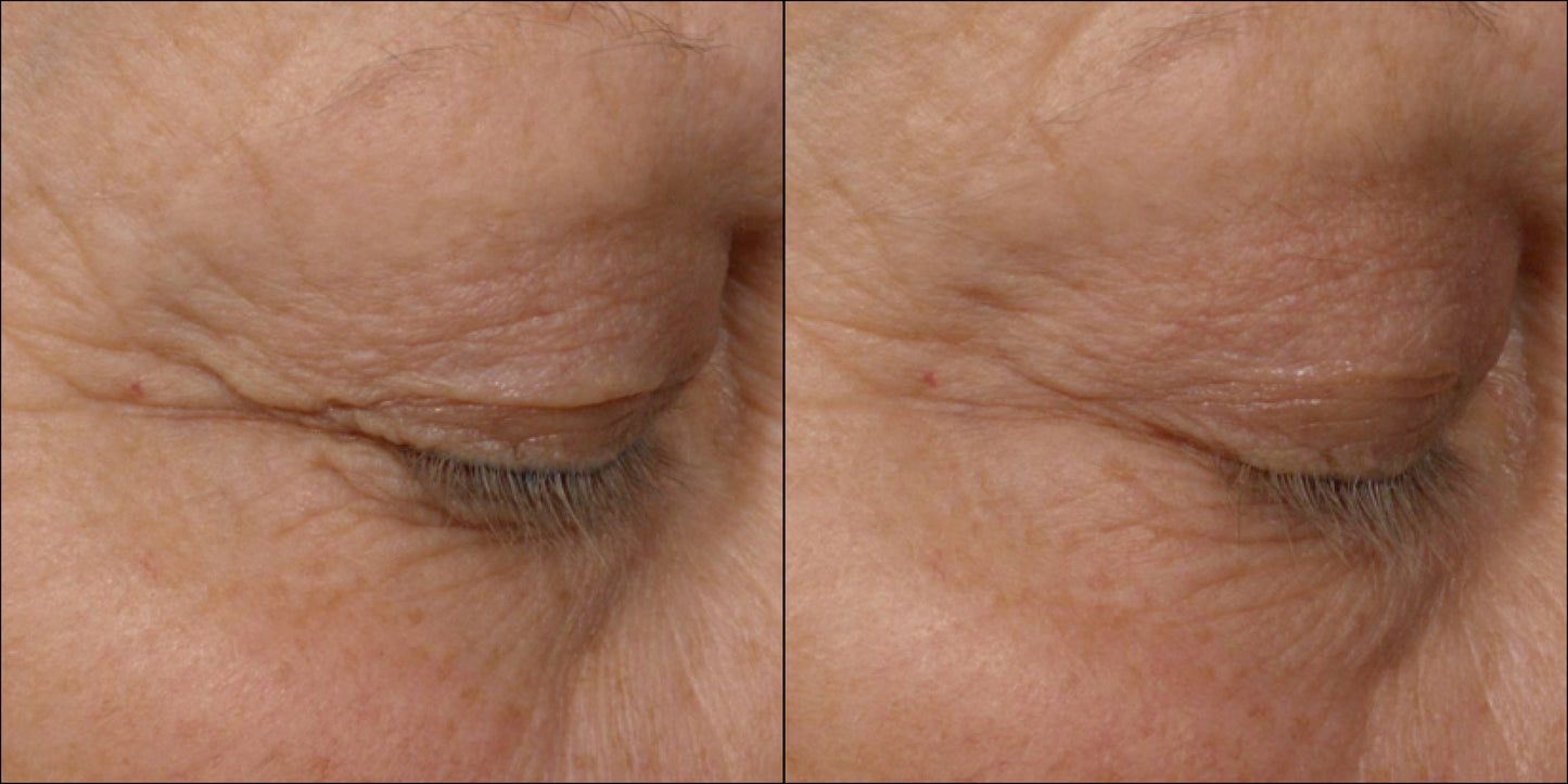 Isomers Skincare Phytocell Lifting Eye Serum 15ml