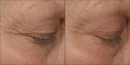 Isomers Skincare Phytocell Lifting Eye Serum 15ml