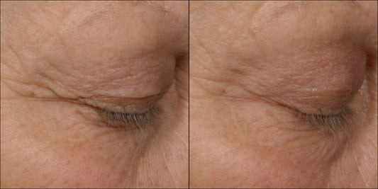 Isomers Skincare Phytocell Lifting Eye Serum 15ml