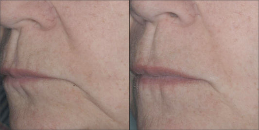 Isomers Skincare Phytocell Rejuvenating Serum BOGO