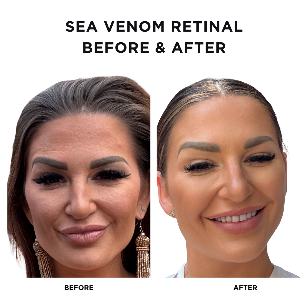 Intoxicated Cosmetics Anti-Aging Sea Venom Retinal