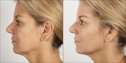 Isomers Skincare "Age Defying" Re-Densify 3-Piece Kit