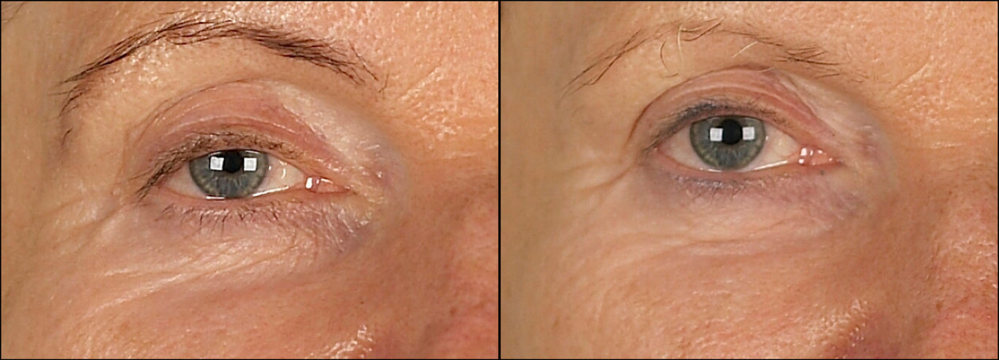 Isomers Skincare Re-Densify Under Eye Serum 15ml