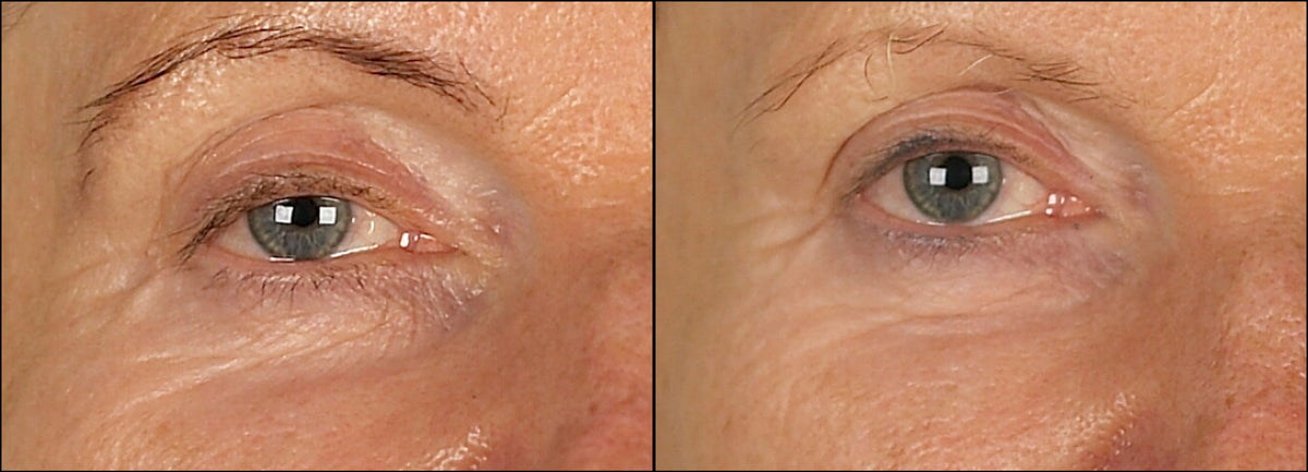 Isomers Skincare Re-Densify Under Eye Serum 15ml