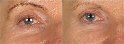 Isomers Skincare Re-Densify Under Eye Serum 15ml