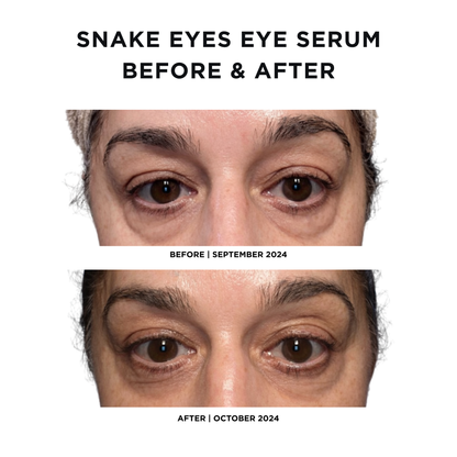 Intoxicated Cosmetics Snake Eyes Eye Serum