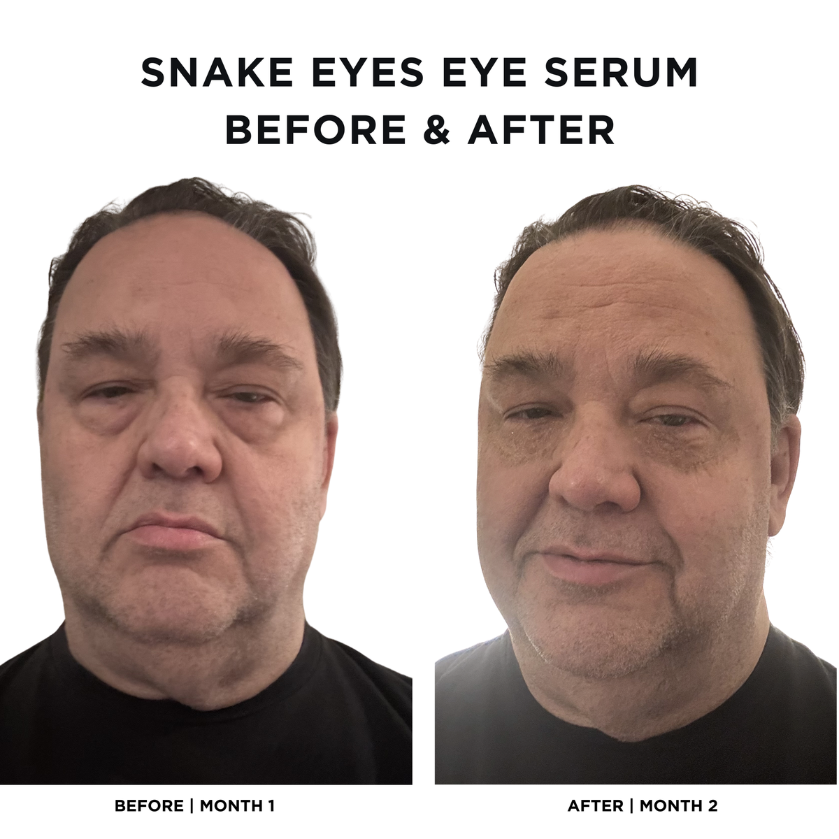 Intoxicated Cosmetics Snake Eyes Eye Serum