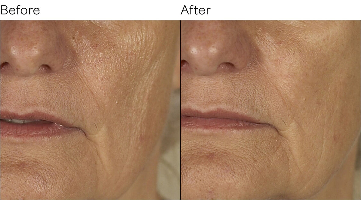 Isomers Skincare Re-Densify Contouring Cream 50ml