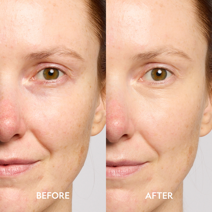 YENSA Super Bright Dark Circle Serum Peptide Corrector